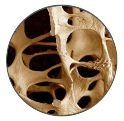 Preventie osteoporose klachten op de bellicon